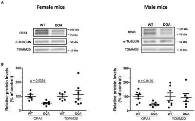 Genetic background modulates phenotypic expressivity in OPA1 mutated mice, relevance to DOA pathogenesis